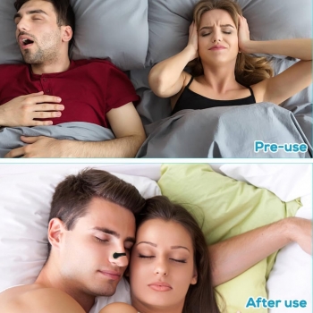 Magnetic+Nasal+Dilator+Strips+for+Breathing++Anti-Snoring+Starter+Kit+Instant+Snore+Relief%2C+Better+Sleep%2C+Skin-Safe